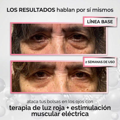 RevitalEye®
