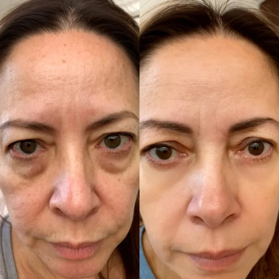 RevitalEye®