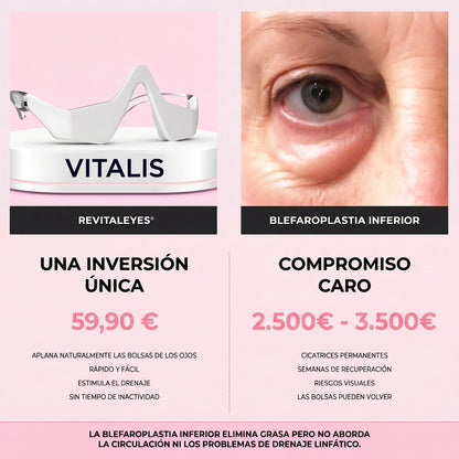 RevitalEye®